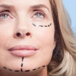 Facelift Surgery Bloomington, IL