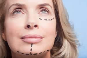 Facelift Surgery Bloomington, IL