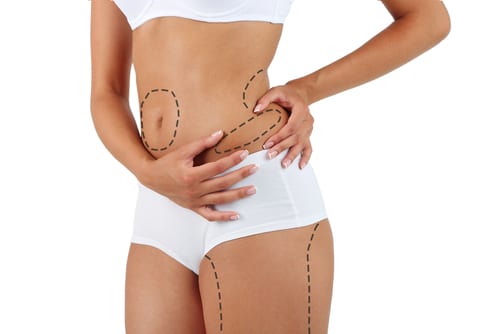 Plastic,Surgery.,Liposuction.,Slim,Body,Concept