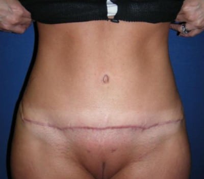 After Image: 3 Children & Lost 20 lbs - front
