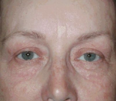 After Image: 58 YearS Old - other