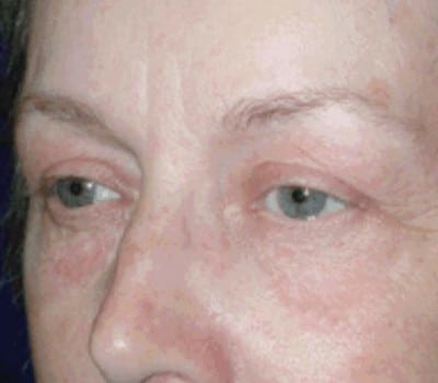 After Image: 58 YearS Old - other