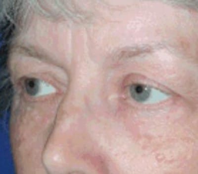 Before Image: 58 YearS Old - other