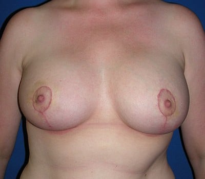 After Image: improved position & enhanced size - front