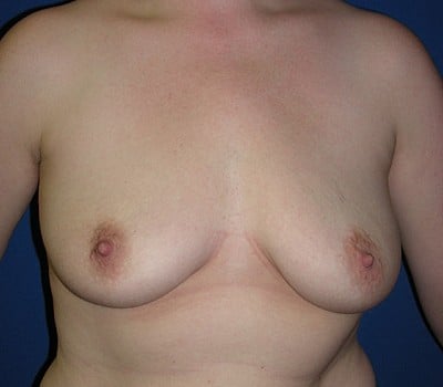 Before Image: improved position & enhanced size - front