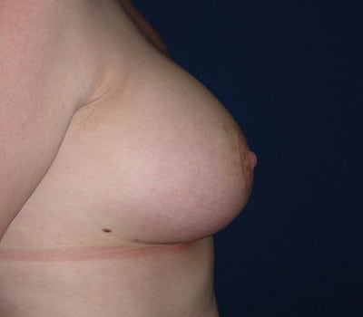 After Image: improved position & enhanced size - other