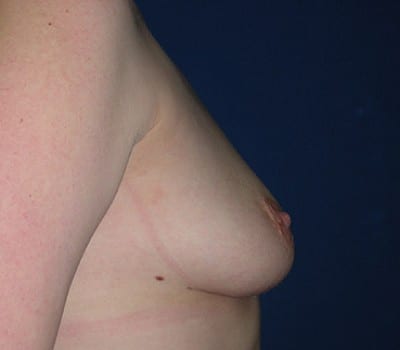 Before Image: improved position & enhanced size - other