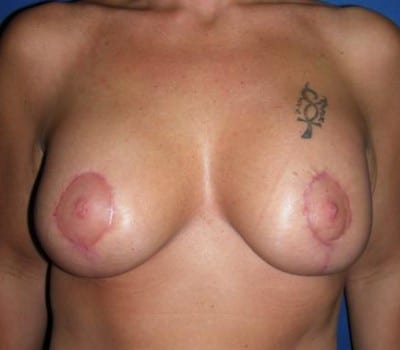 After Image: improved contour and size - front