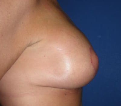 After Image: improved contour and size - other