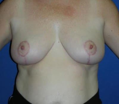 After Image: 39 Years Old - front