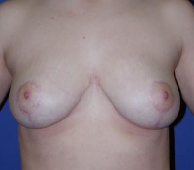 After Image: 21 Years Old - front