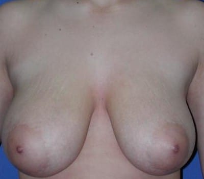 Before Image: 21 Years Old - front