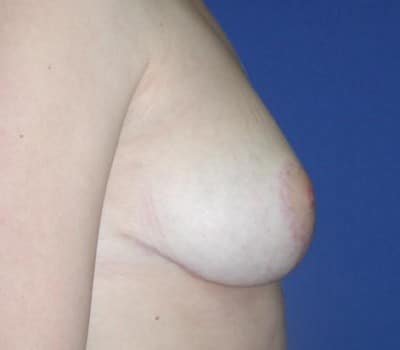 After Image: 21 Years Old - other