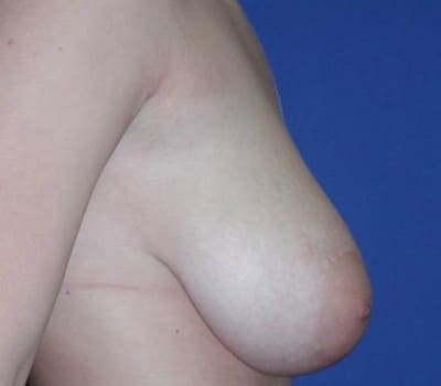 Before Image: 21 Years Old - other