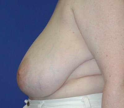 Before Image: Removed 1008g Left & 659g Right - other