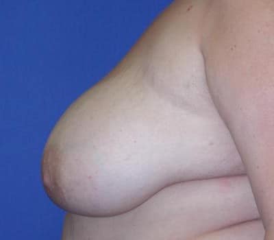 Before Image: Removed 808g Right & 709g Left - other