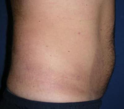 After Image: 42 Years Old Male - other