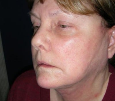 After Image: 62 Years Old - other