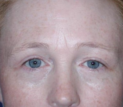 After Image: 44 Years Old - other